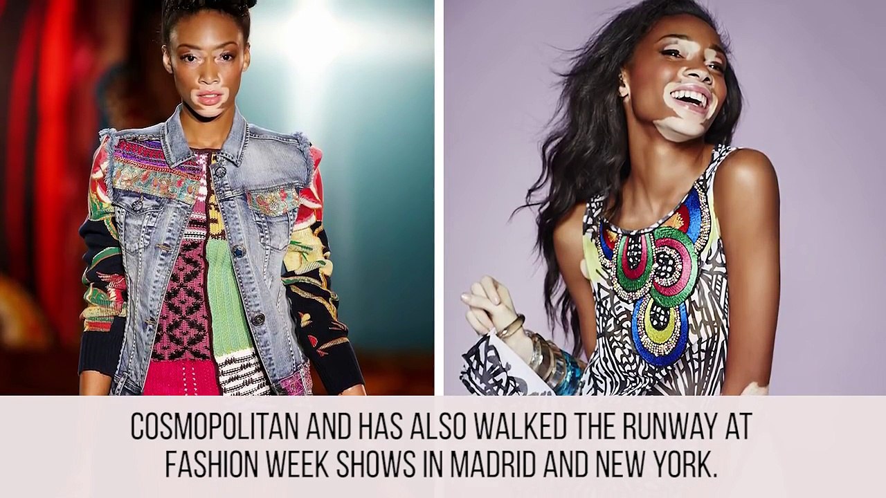 10 Unique Models Revolutionizing The Fashion World