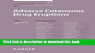 PDF Adverse Cutaneous Drug Eruptions  Read Online