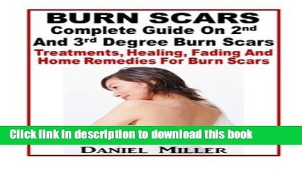 Read Burn Scars : Complete Guide On 2nd And 3rd Degree Burn Scars: Treatments, Healing, Fading And