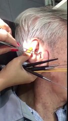 Just for laugh ★ Ear wax removal service in Vietnam ★ Ráy tai thư giãn