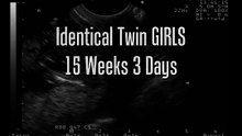 Twin Gender Ultrasound - Girls! 15 weeks 3 days