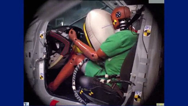 Les airbags et la ceinture de sécurité efficaces contre le risque de fracture faciale