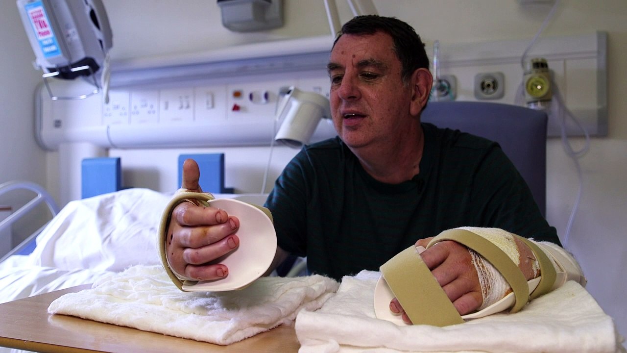 Double hand transplant recipient feels "whole" again