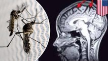 Zika virus may damage adult brain cells, causing long term memory loss like Alzheimer’s - TomoNews