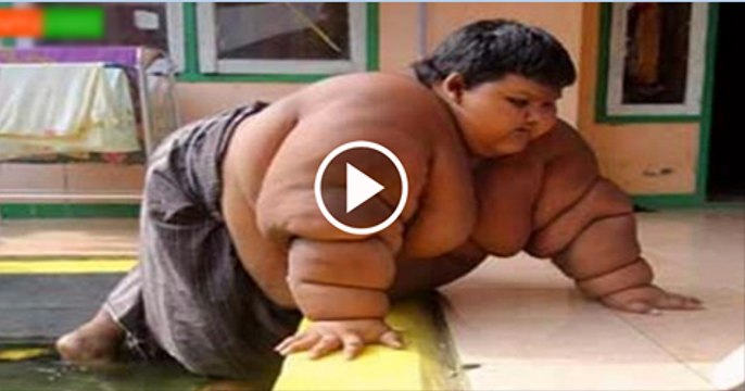 10-year-old son weighs 192 kg