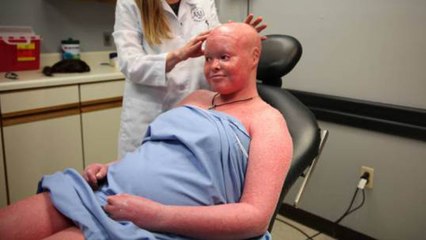 10 Most Rare Diseases In The World