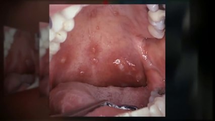 A sua filha de 10 anos morreu subitamente... O que os médicos lhe encontraram na boca é alarmante!