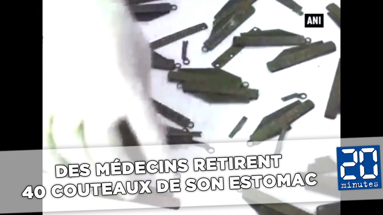 Des médecins retirent 40 couteaux de l’estomac d’un homme