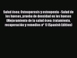 Read Salud ósea: Osteoporosis y osteopenia - Salud de los huesos prueba de densidad en los