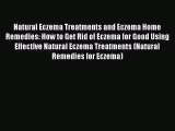 Read Natural Eczema Treatments and Eczema Home Remedies: How to Get Rid of Eczema for Good