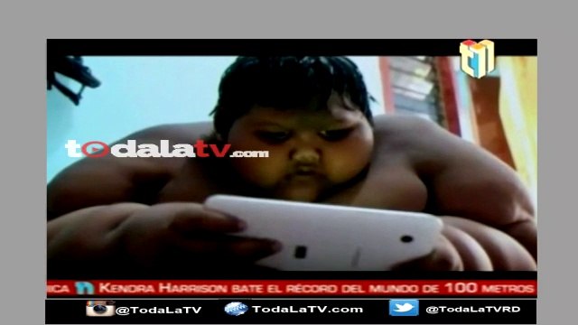 El niño más obeso del mundo-Telenoticias-Video