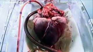 How a Plastic Artificial Heart Works .. An Educational Video