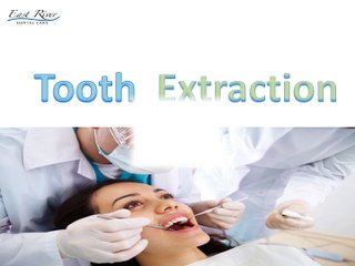 Extraction of a tooth - East River Dental Care - Newmarket - Ontario - Canada