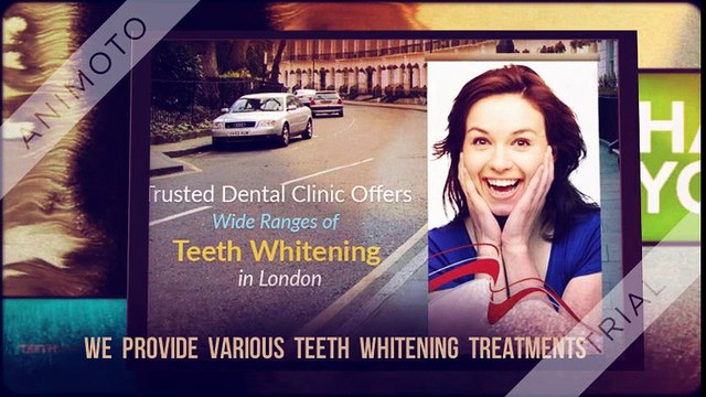 London Teeth Whitening – Providing High Quality Teeth Whitening Treatments
