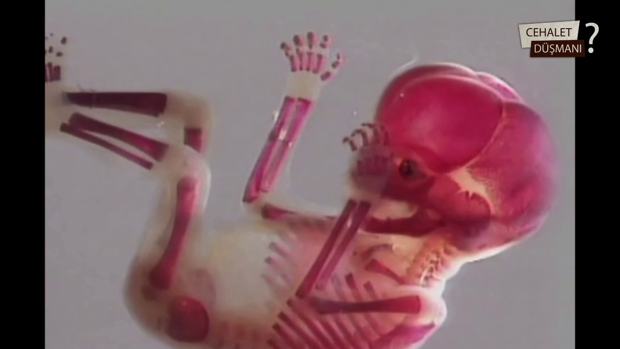 Anne karnında neler oluyor - In the WOMB