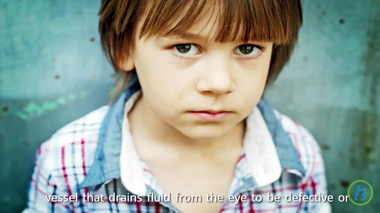 Child Glaucoma Gene Discovered