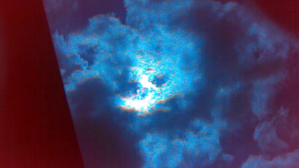 palpitations + disque se déplaçant