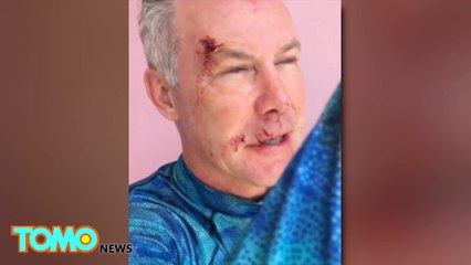 Texas tourist survives attack from 6-foot bull shark