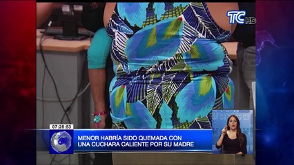 Mujer habría quemado la boca de su hija de 4 años