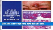 Download Atlas of Skin Cancers Processed by Frozen Sections and Mohs Surgery [PDF] Online