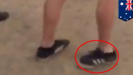 Man ends up with backward foot after breaking it at music festival, then walks away