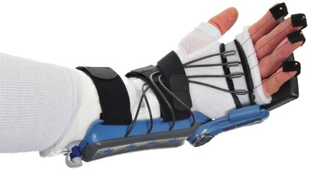 Riabilitazione tendine estensore dito