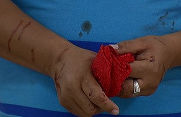 Hombre asegura que su expareja lo atacó con una tijera