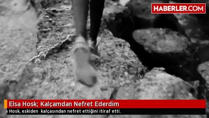 Elsa Hosk: Kalçamdan Nefret Ederdim