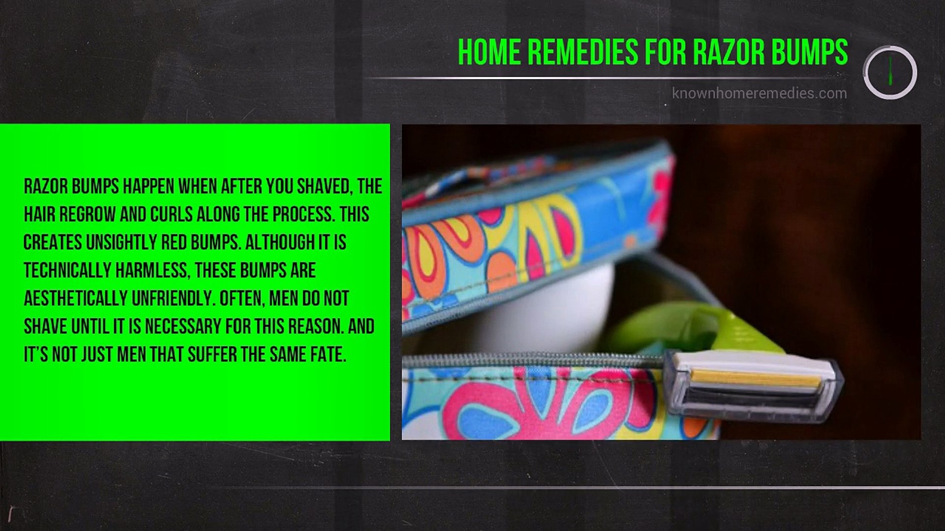 Ideal Remedies For Razor Bumps That Can Be Found At Home Video