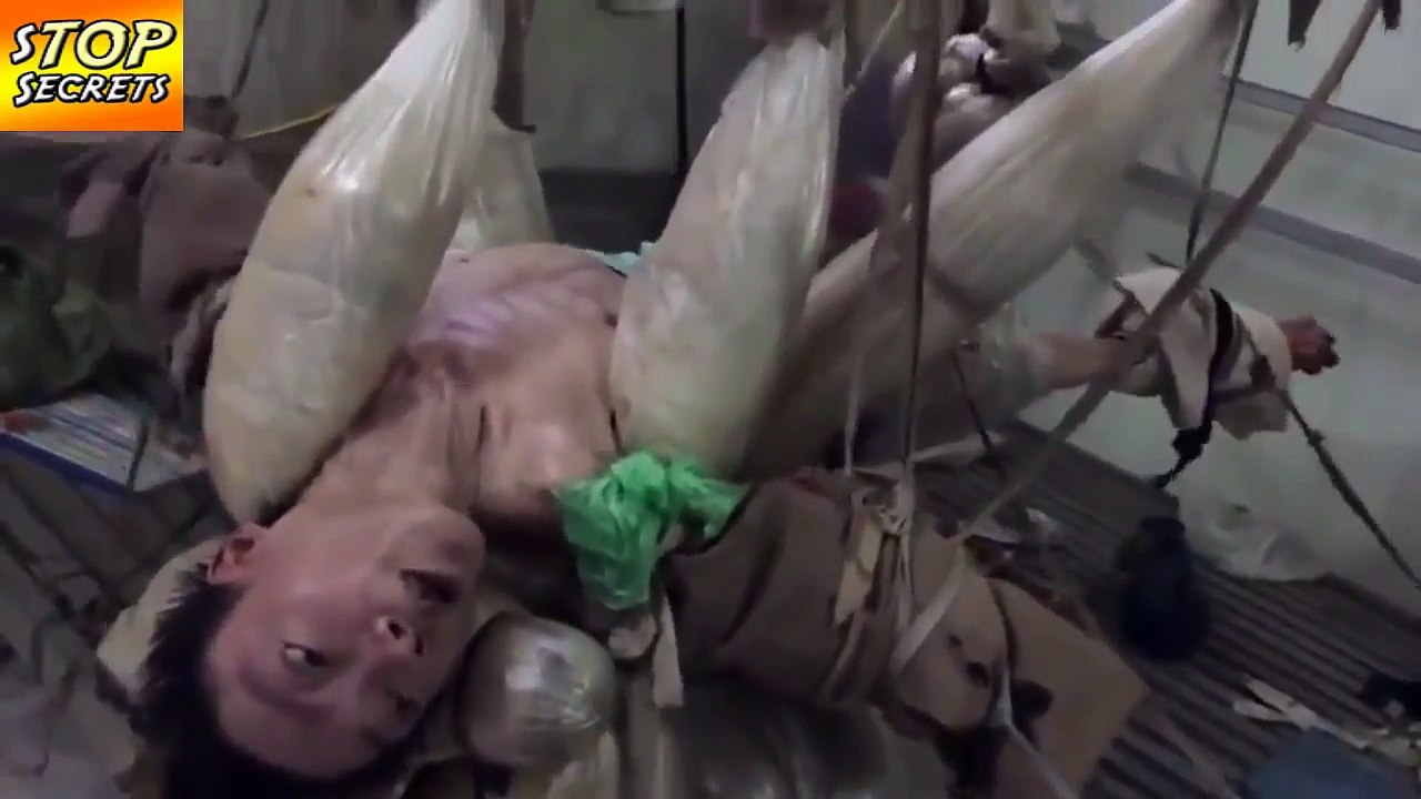 Man is 47 YEARS Living Suspended in the House