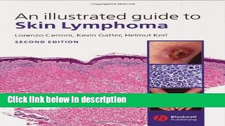 Books An Illustrated Guide to Skin Lymphoma Full Online