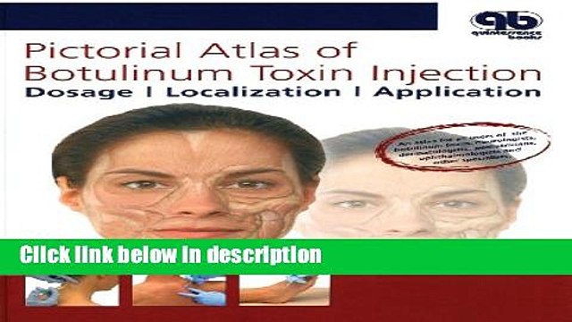 Books Pictorial Atlas of Botulinum Toxin Injection: Dosage, Localization, Application Free Online