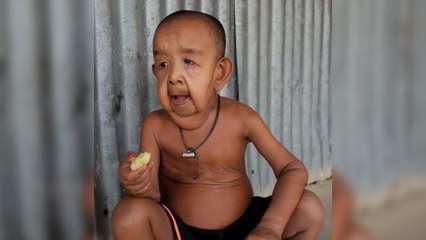 Un petit garçon de 4 ans a l'apparence d'une personne âgée