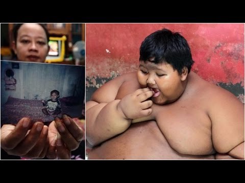 World's heaviest child put on crash diet over health fears