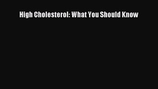 DOWNLOAD FREE E-books  High Cholesterol: What You Should Know  Full Free