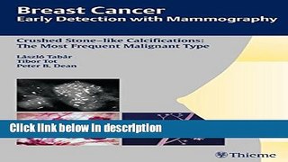 Ebook Breast Cancer: Early Detection with Mammography: Crushed Stone-like Calcifications: The Most
