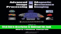 Ebook Advanced Image Processing in Magnetic Resonance Imaging (Signal Processing and