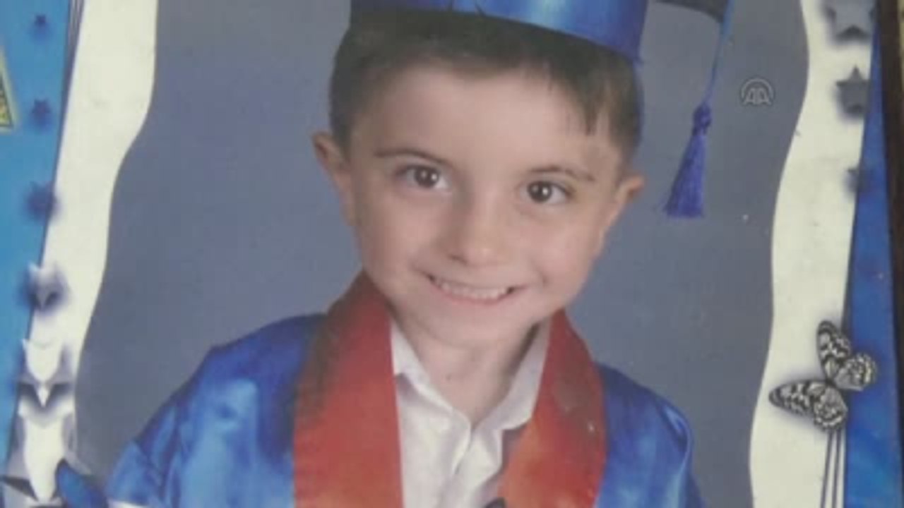 Kafasında "Maganda Kurşunu" ile Yaşıyor