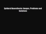 Free Full [PDF] Downlaod  Epidural Anaesthesia: Images Problems and Solutions  Full Ebook