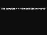 READ book  Hair Transplant 360: Follicular Unit Extraction (FUE)  Full Ebook Online Free