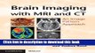 Ebook|Books} Brain Imaging with MRI and CT: An Image Pattern Approach Full Online