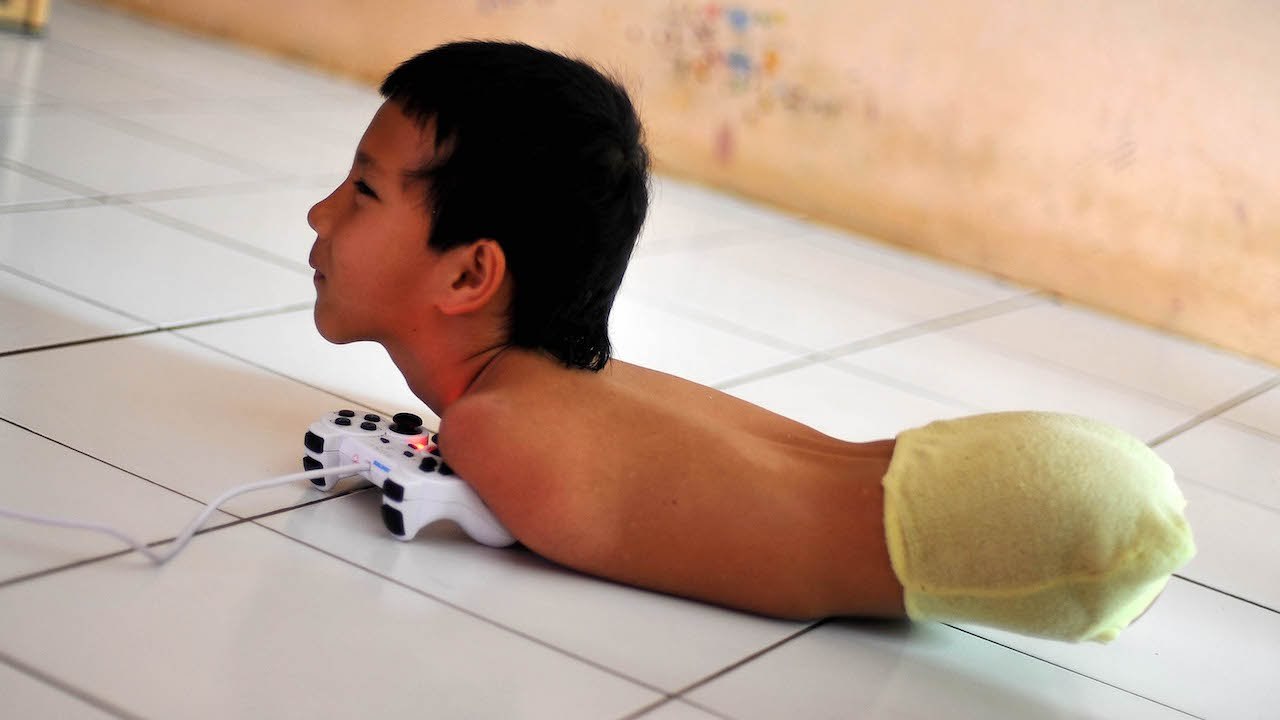 Boy Uses Chin And Shoulder To Play- BORN DIFFERENT