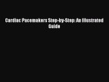 [PDF] Cardiac Pacemakers Step-by-Step: An Illustrated Guide Download Full Ebook
