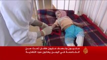 مليون ونصف من أطفال اليمن يعانون سوء التغذية