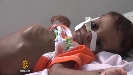 Millions living with hunger in war-torn Yemen