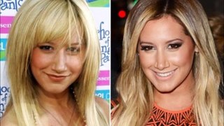 12 Celebrities Before and After Surgery