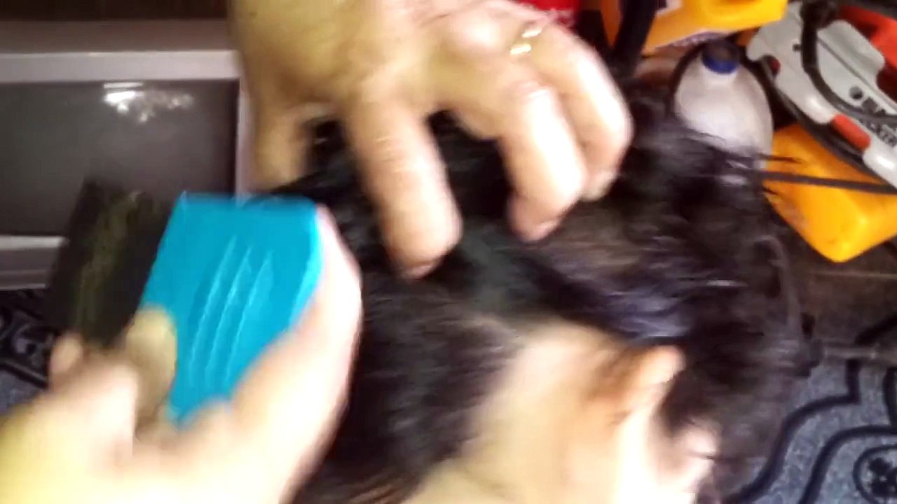 Ce gamin a les cheveux infestés de poux