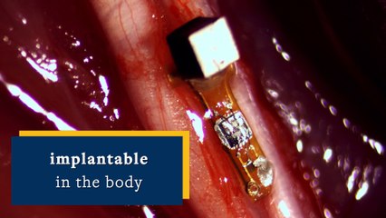 Diseñan sensores implantables del tamaño de un grano de arena