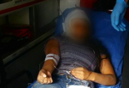 Mujer perdió parte de su cuero cabelludo en accidente al norte de Quito