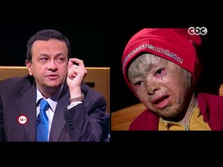 حصلت قبل كده | دكتور حامد عبدالله يكشف تفاصيل المرض الغريب " السمكية "